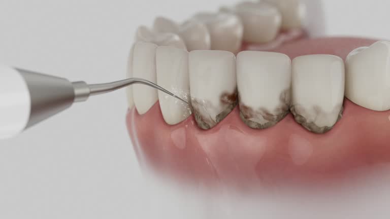 Trusted Wisdom Tooth Removal service in Middle Valley, TN - Dentist Open Now